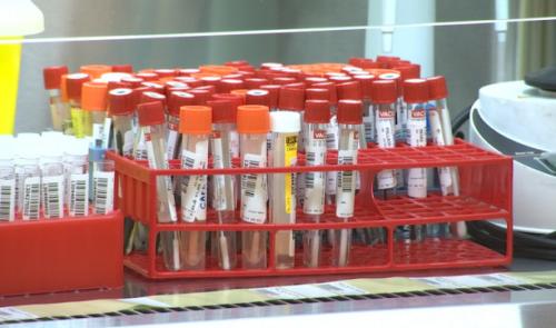 Dépistage de la Covid-19 : les laboratoires hospitaliers sont débordés