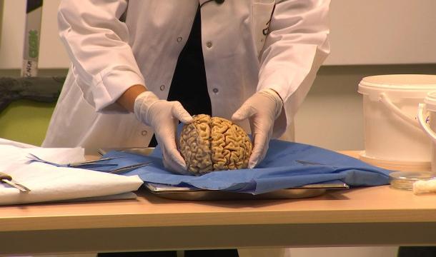 Ils assistent à une dissection d'un cerveau ! 