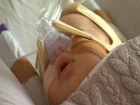 Epidémie de bronchiolites : les hospitalisations