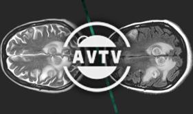AVTV - Le changement d'heure