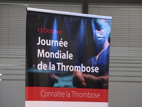 Journée de prévention de la thrombose au CHC