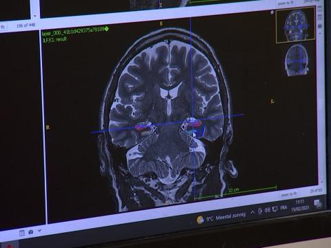 La Province de Liège intensifie la lutte contre Alzheimer