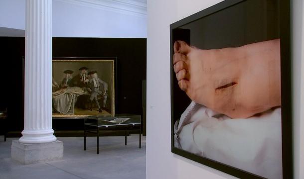 Quand médecine et art se rencontrent, à la Boverie 