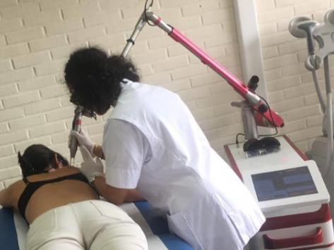 Se faire retirer un tatouage avec moins de douleurs et de frais