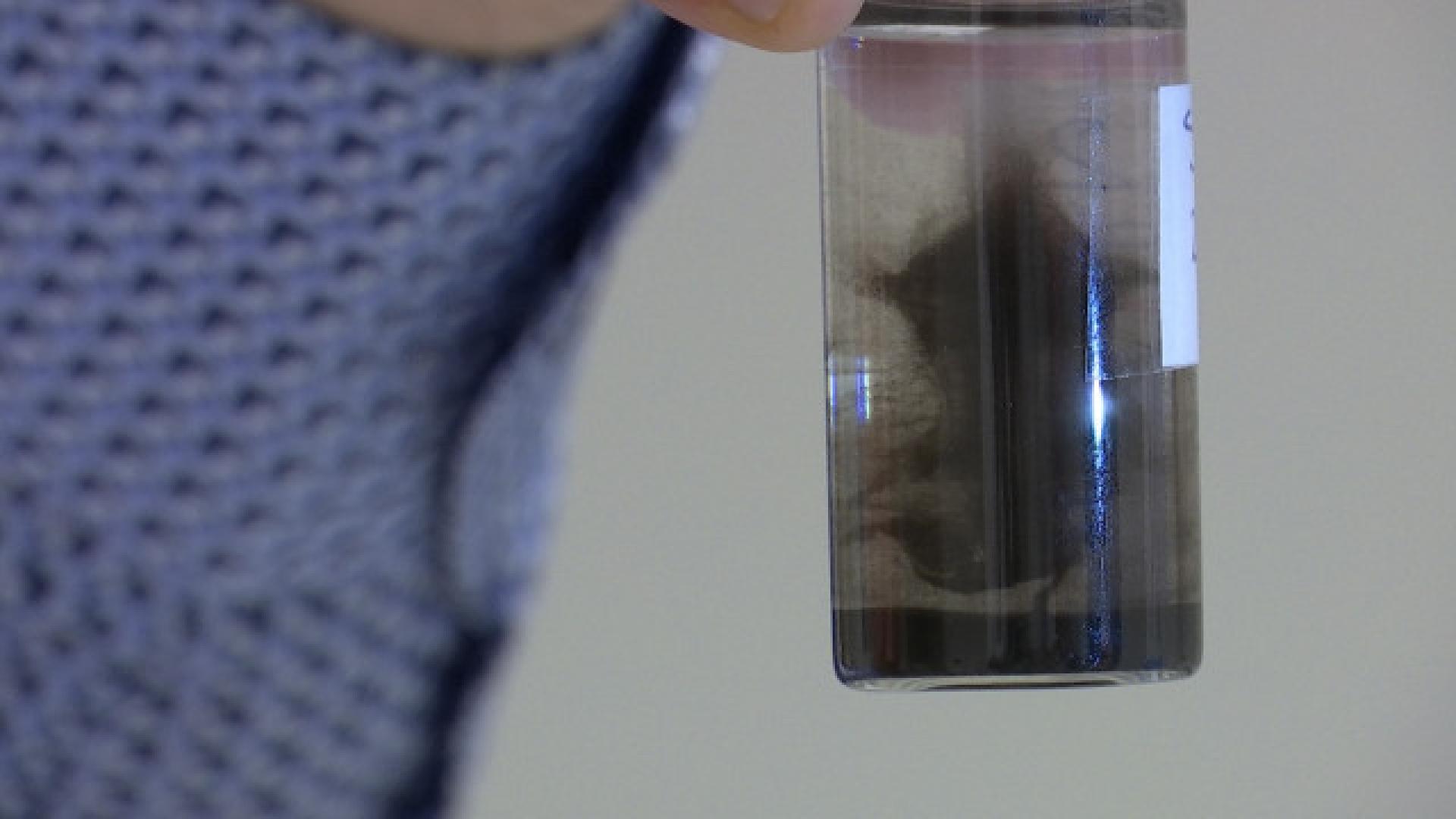 L’ULiège met au point un test automatisé de détection du Covid-19