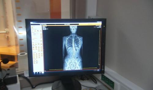 Osimis, spin-off du CHU, révolutionne l'imagerie médicale