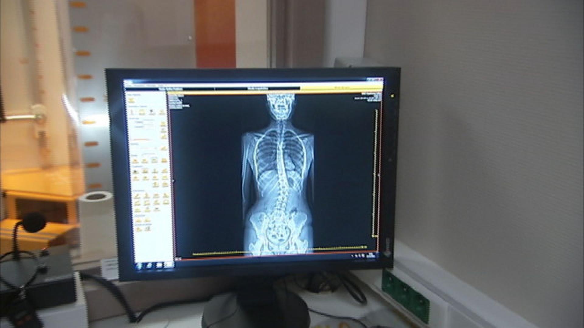 Osimis, spin-off du CHU, révolutionne l'imagerie médicale