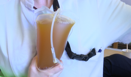 Pénurie de plasma sanguin