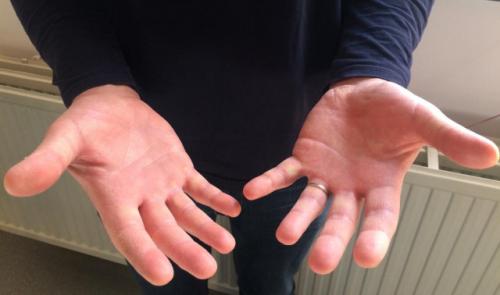 Préserver ses mains face à la crise du Covid-19