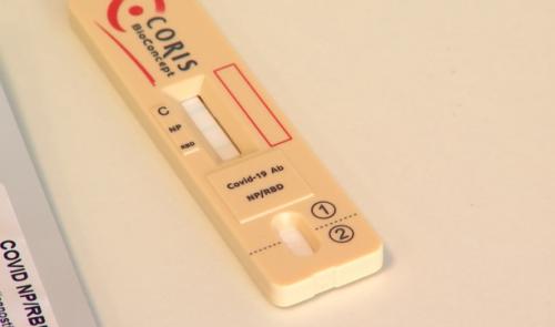 Un nouveau test sérologique unique en son genre produit à Seraing