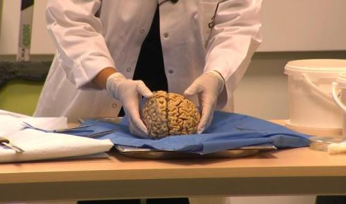 Ils assistent à une dissection d'un cerveau ! 