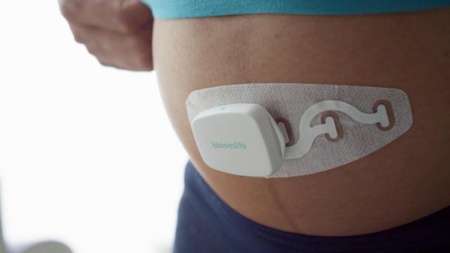 Bloomlife et son monitoring de grossesse, récompensé à Las Vegas !