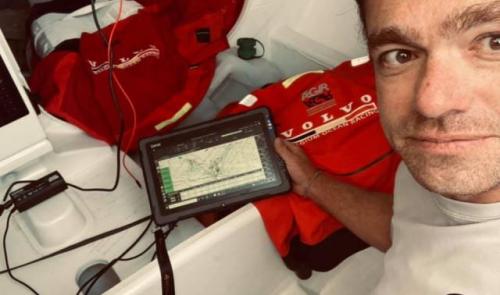 Voile : le skipper Jonas Gerckens sérieusement blessé à 32 jours de la Transat Jacques Vabres ! 