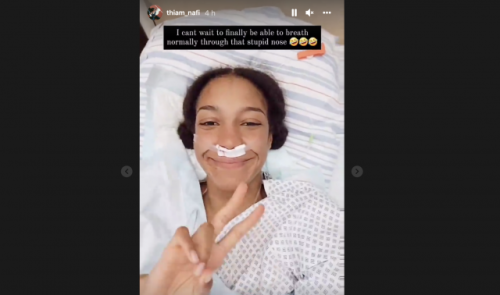 Nafi Thiam a été opérée du nez