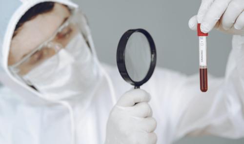 Covid-19 : une solution pour réduire le taux de mortalité en cas de détresse respiratoire