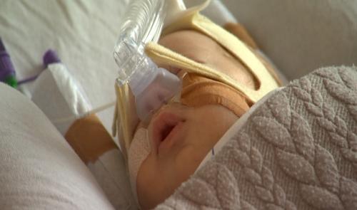 Epidémie de bronchiolites : les hospitalisations