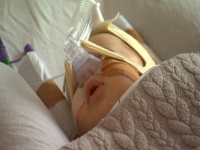 Epidémie de bronchiolites : les hospitalisations