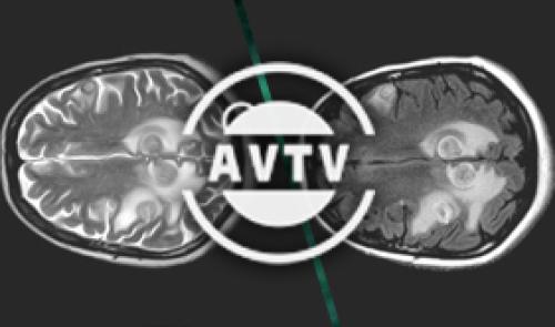 AVTV - Le changement d'heure