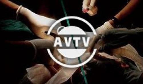 AVTV - Le don d'organes
