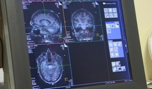 Le sommeil est important pour la mémorisation