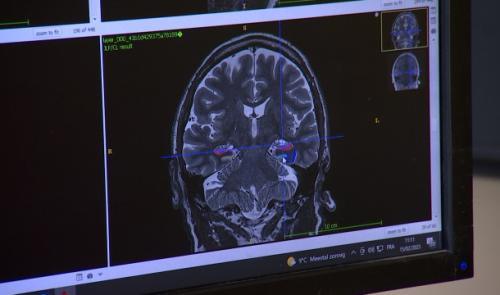 La Province de Liège intensifie la lutte contre Alzheimer
