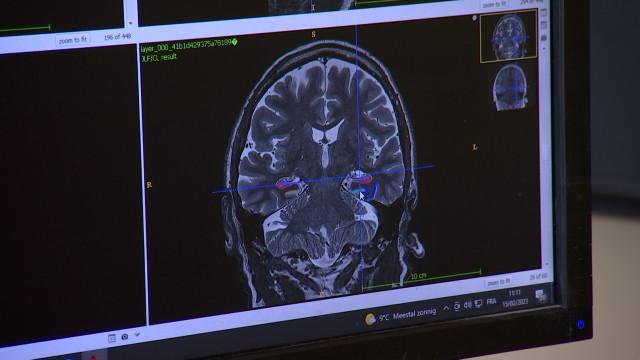 La Province de Liège intensifie la lutte contre Alzheimer