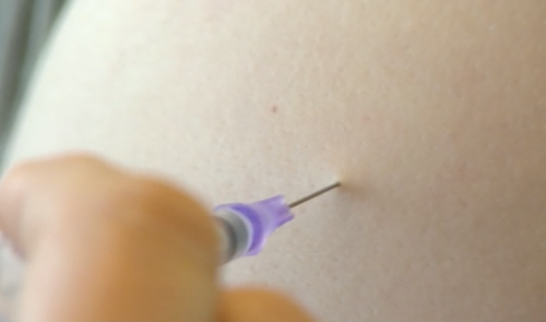 Le deuxième vaccin entre en action à la Clinique André Renard