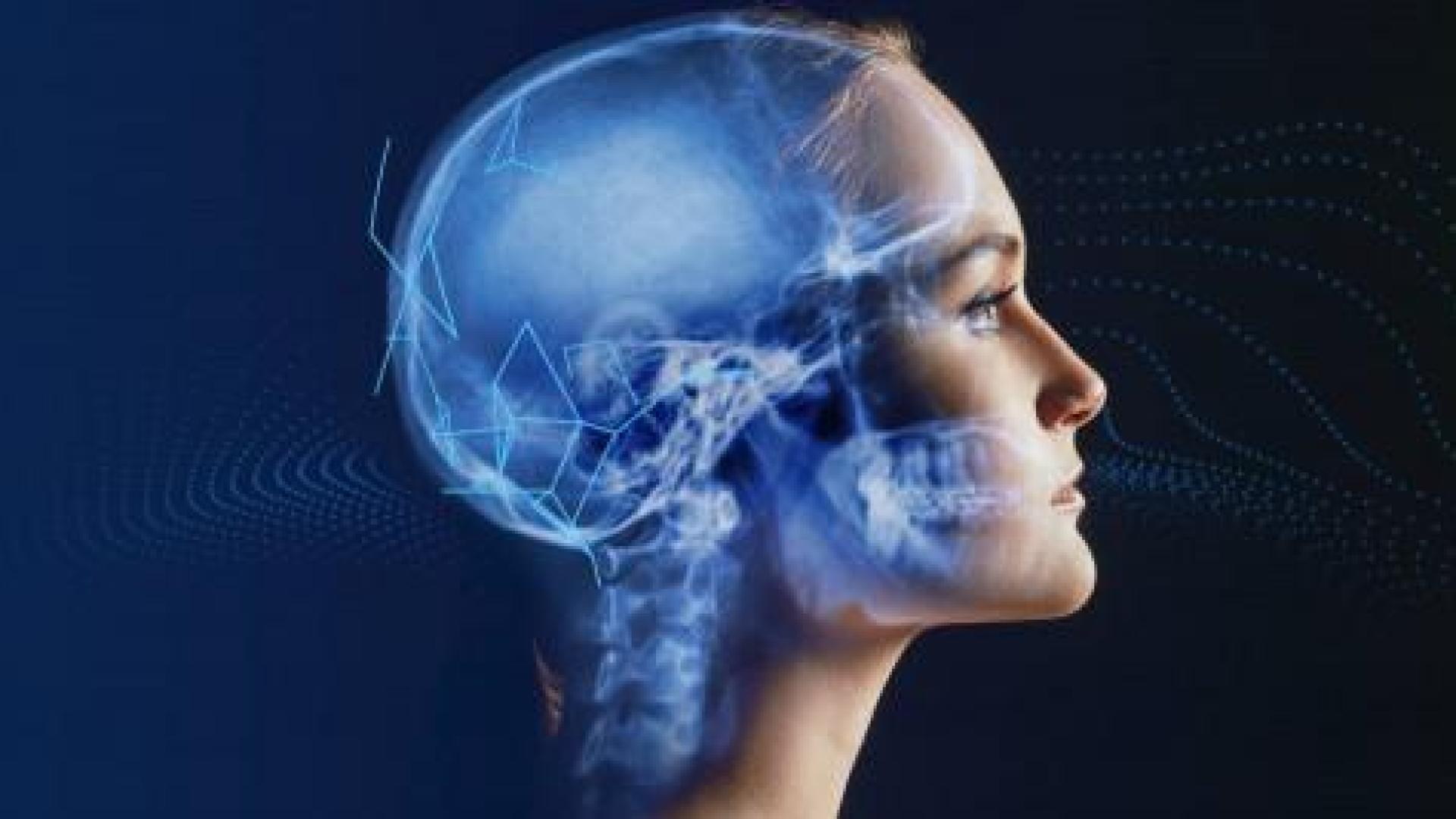 Osimis lève 1,6 million d'euros pour développer l'intelligence artificielle dans l'imagerie médicale