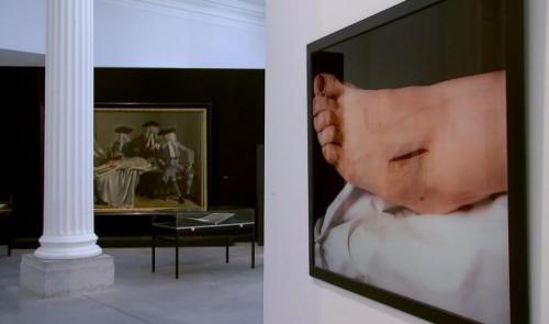 Quand médecine et art se rencontrent, à la Boverie 