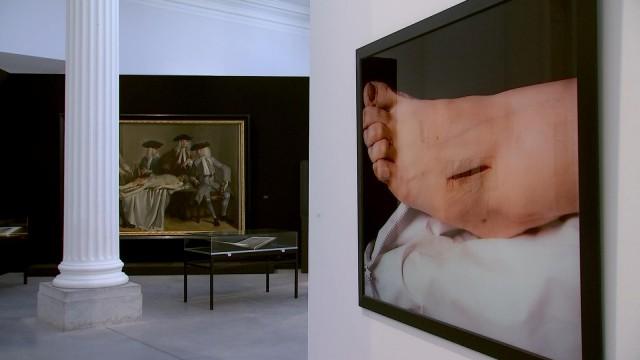 Quand médecine et art se rencontrent, à la Boverie 