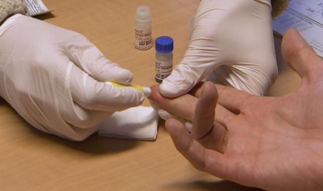 Sida Sol: baisse des dépistages suite au Covid