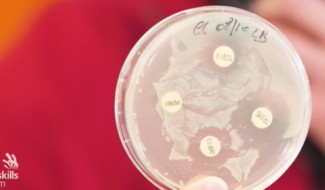 Steam by skills: le fonctionnement des antibiotiques