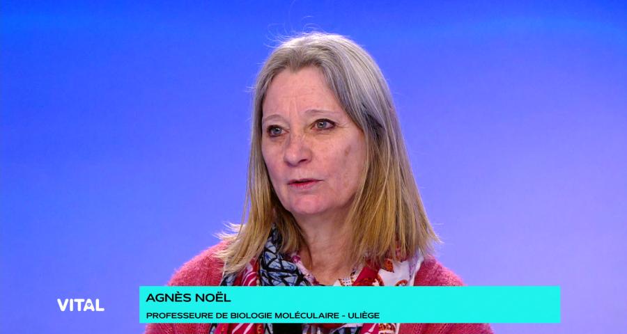 Lymphœdème : Un défi médical méconnu